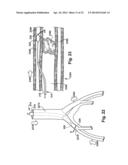 APPARATUS AND METHOD FOR TARGETING A BODY TISSUE diagram and image