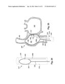 APPARATUS AND METHOD FOR TARGETING A BODY TISSUE diagram and image