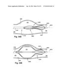 APPARATUS AND METHOD FOR TARGETING A BODY TISSUE diagram and image