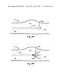 APPARATUS AND METHOD FOR TARGETING A BODY TISSUE diagram and image