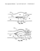 APPARATUS AND METHOD FOR TARGETING A BODY TISSUE diagram and image