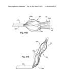 APPARATUS AND METHOD FOR TARGETING A BODY TISSUE diagram and image