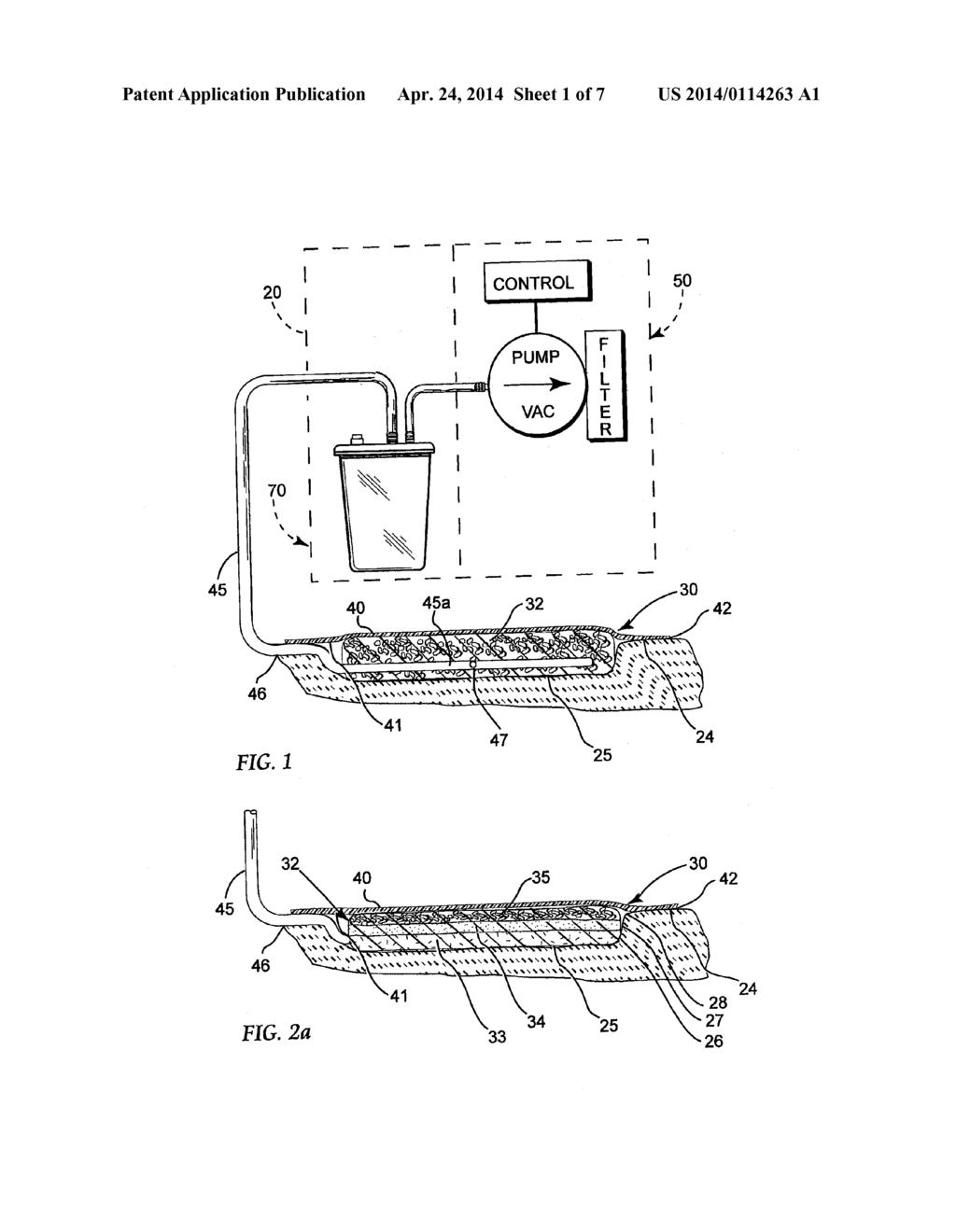 REDUCED PRESSURE TREATMENT SYSTEM - diagram, schematic, and image 02