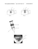 MATERIALS AND METHODS FOR REPAIR OF CARTILAGE DEFECTS diagram and image