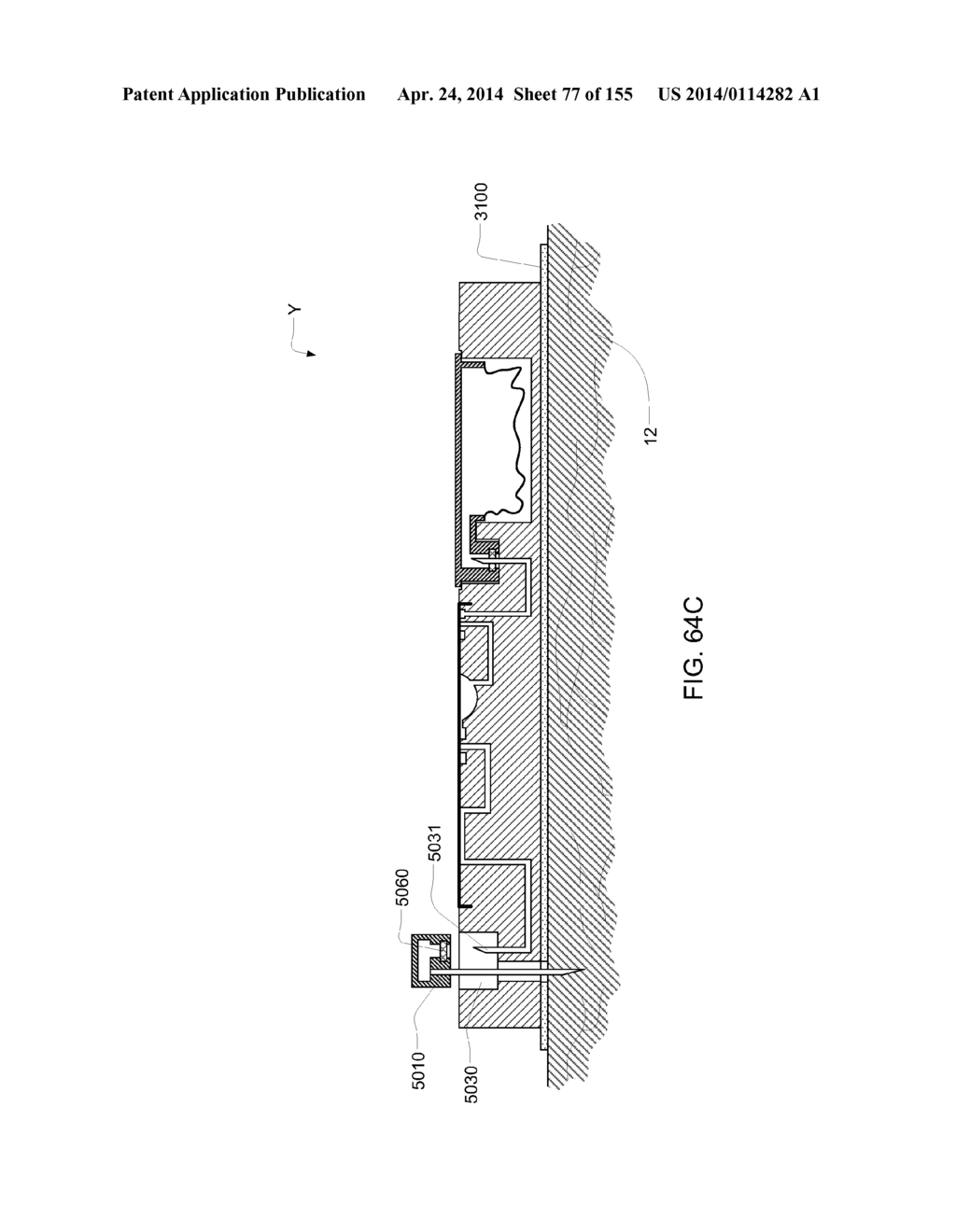 Patch-Sized Fluid Delivery Systems and Methods - diagram, schematic, and image 78