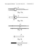 ARTHROSCOPIC BONE TRANSPLANTING PROCEDURE, AND MEDICAL INSTRUMENTS USEFUL     THEREIN diagram and image