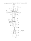 KNEE JOINT PROSTHESIS SYSTEM AND METHOD FOR IMPLANTATION diagram and image