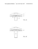 KNEE JOINT PROSTHESIS SYSTEM AND METHOD FOR IMPLANTATION diagram and image