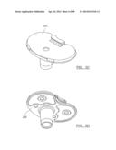 KNEE JOINT PROSTHESIS SYSTEM AND METHOD FOR IMPLANTATION diagram and image