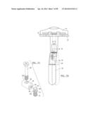 KNEE JOINT PROSTHESIS SYSTEM AND METHOD FOR IMPLANTATION diagram and image