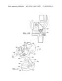 KNEE JOINT PROSTHESIS SYSTEM AND METHOD FOR IMPLANTATION diagram and image