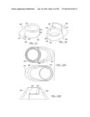 KNEE JOINT PROSTHESIS SYSTEM AND METHOD FOR IMPLANTATION diagram and image