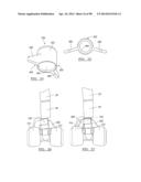 KNEE JOINT PROSTHESIS SYSTEM AND METHOD FOR IMPLANTATION diagram and image