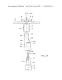 KNEE JOINT PROSTHESIS SYSTEM AND METHOD FOR IMPLANTATION diagram and image