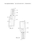 KNEE JOINT PROSTHESIS SYSTEM AND METHOD FOR IMPLANTATION diagram and image