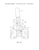 KNEE JOINT PROSTHESIS SYSTEM AND METHOD FOR IMPLANTATION diagram and image