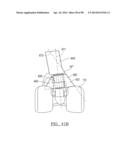 KNEE JOINT PROSTHESIS SYSTEM AND METHOD FOR IMPLANTATION diagram and image