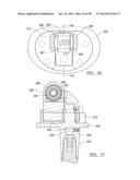 KNEE JOINT PROSTHESIS SYSTEM AND METHOD FOR IMPLANTATION diagram and image