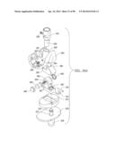 KNEE JOINT PROSTHESIS SYSTEM AND METHOD FOR IMPLANTATION diagram and image