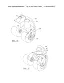 KNEE JOINT PROSTHESIS SYSTEM AND METHOD FOR IMPLANTATION diagram and image