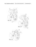 KNEE JOINT PROSTHESIS SYSTEM AND METHOD FOR IMPLANTATION diagram and image