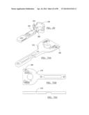 KNEE JOINT PROSTHESIS SYSTEM AND METHOD FOR IMPLANTATION diagram and image