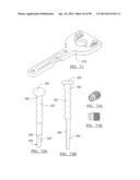 KNEE JOINT PROSTHESIS SYSTEM AND METHOD FOR IMPLANTATION diagram and image