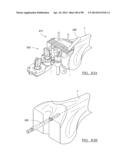 KNEE JOINT PROSTHESIS SYSTEM AND METHOD FOR IMPLANTATION diagram and image