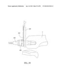 KNEE JOINT PROSTHESIS SYSTEM AND METHOD FOR IMPLANTATION diagram and image