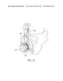 KNEE JOINT PROSTHESIS SYSTEM AND METHOD FOR IMPLANTATION diagram and image