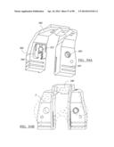 KNEE JOINT PROSTHESIS SYSTEM AND METHOD FOR IMPLANTATION diagram and image