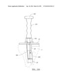 KNEE JOINT PROSTHESIS SYSTEM AND METHOD FOR IMPLANTATION diagram and image