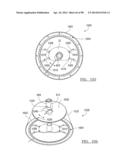 KNEE JOINT PROSTHESIS SYSTEM AND METHOD FOR IMPLANTATION diagram and image