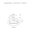 KNEE JOINT PROSTHESIS SYSTEM AND METHOD FOR IMPLANTATION diagram and image