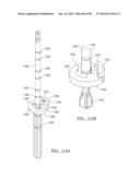 KNEE JOINT PROSTHESIS SYSTEM AND METHOD FOR IMPLANTATION diagram and image