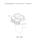 KNEE JOINT PROSTHESIS SYSTEM AND METHOD FOR IMPLANTATION diagram and image