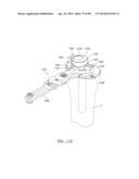 KNEE JOINT PROSTHESIS SYSTEM AND METHOD FOR IMPLANTATION diagram and image