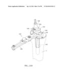 KNEE JOINT PROSTHESIS SYSTEM AND METHOD FOR IMPLANTATION diagram and image