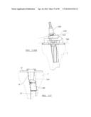 KNEE JOINT PROSTHESIS SYSTEM AND METHOD FOR IMPLANTATION diagram and image