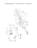 KNEE JOINT PROSTHESIS SYSTEM AND METHOD FOR IMPLANTATION diagram and image