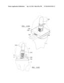 KNEE JOINT PROSTHESIS SYSTEM AND METHOD FOR IMPLANTATION diagram and image