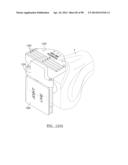 KNEE JOINT PROSTHESIS SYSTEM AND METHOD FOR IMPLANTATION diagram and image