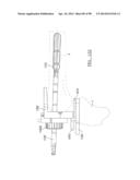 KNEE JOINT PROSTHESIS SYSTEM AND METHOD FOR IMPLANTATION diagram and image