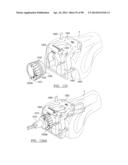 KNEE JOINT PROSTHESIS SYSTEM AND METHOD FOR IMPLANTATION diagram and image