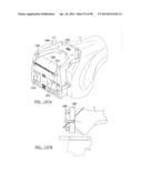 KNEE JOINT PROSTHESIS SYSTEM AND METHOD FOR IMPLANTATION diagram and image