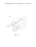 KNEE JOINT PROSTHESIS SYSTEM AND METHOD FOR IMPLANTATION diagram and image