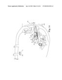 VAGINAL MANIPULATOR HEAD WITH TISSUE INDEX AND HEAD EXTENDER diagram and image