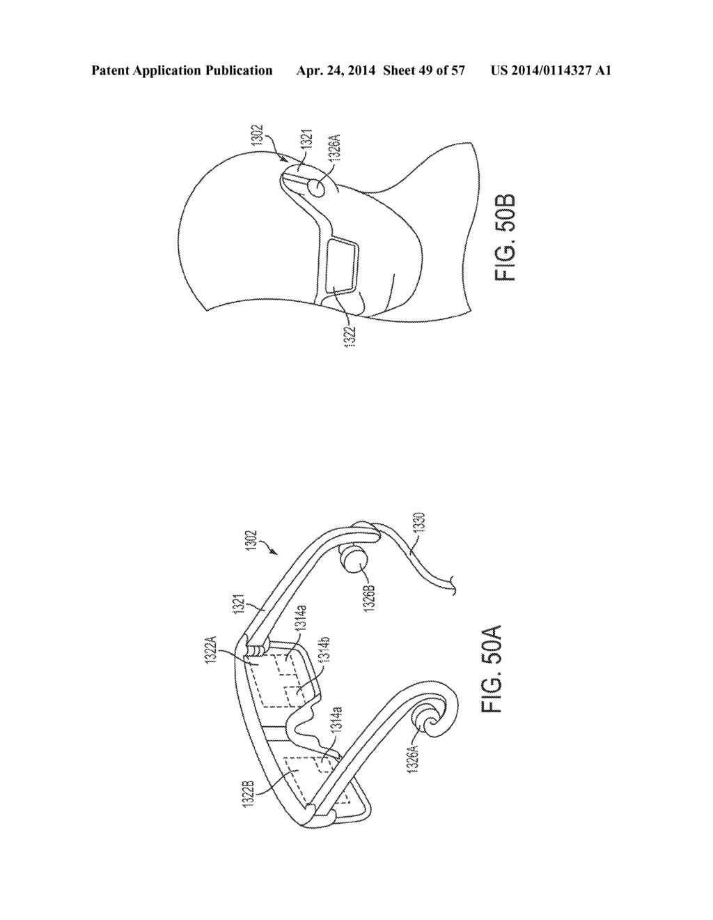 SURGEON FEEDBACK SENSING AND DISPLAY METHODS - diagram, schematic, and image 50