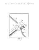 ADJUSTABLE SUTURE RESTRICTION SYSTEM AND METHOD diagram and image