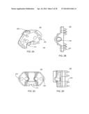 Implantation Tools for Interspinous Process Spacing Device diagram and image